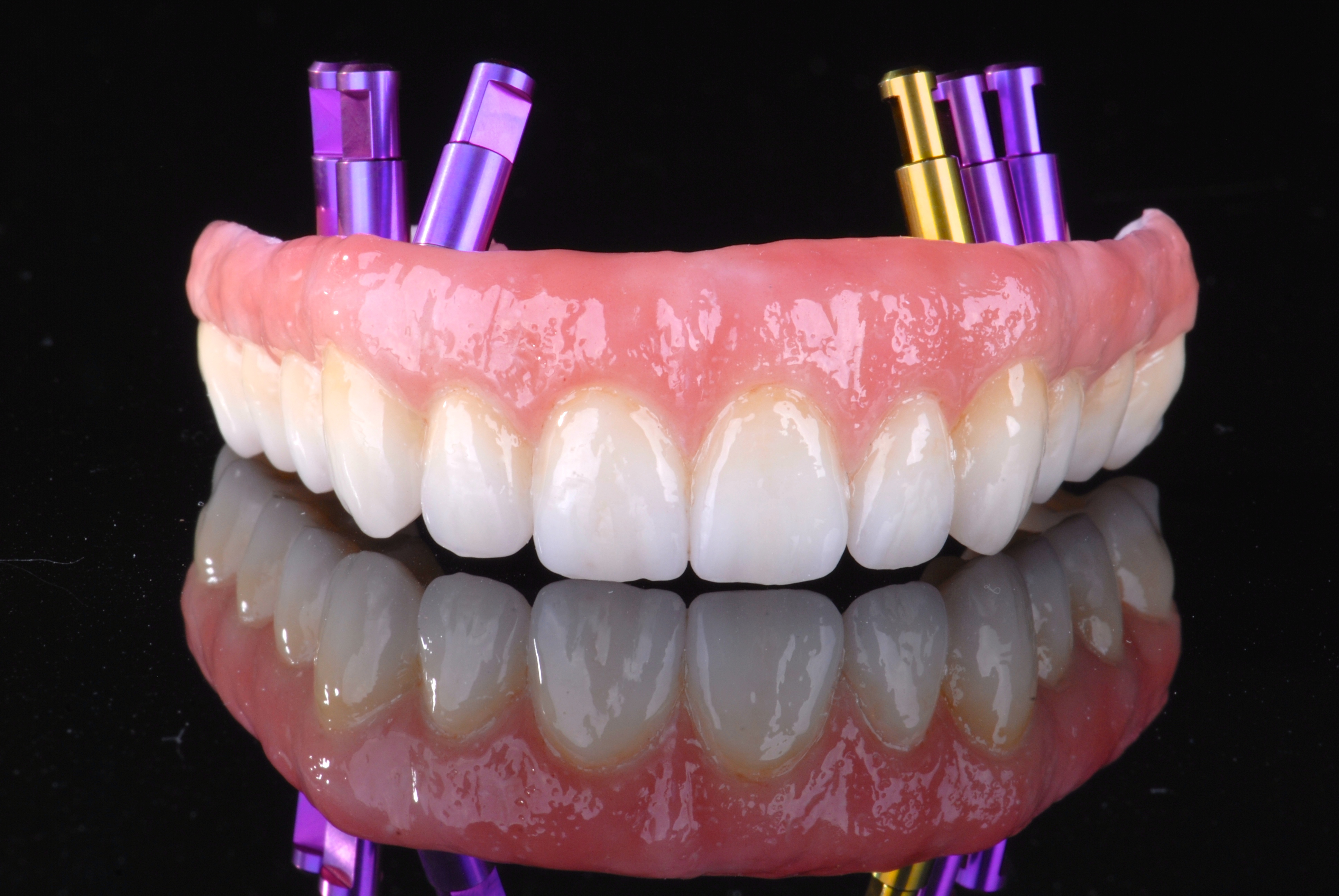 We will guide you through the selection process and ensure the highest precision in implementation.